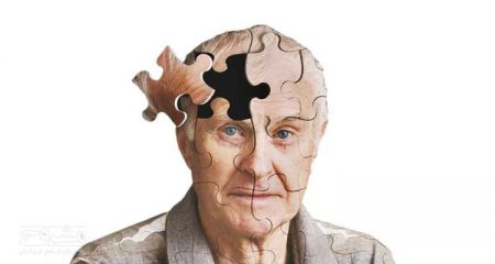اخبار,اخبار پزشکی,آلزایمر اخبار,اخبار پزشکی,آلزایمر