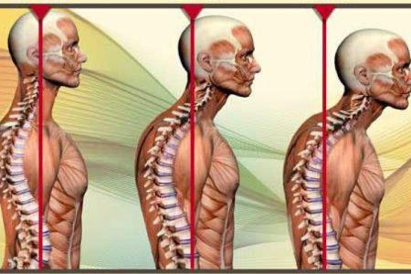 اخبار,اخبار پزشکی,ناهنجاریهای جسمانی اخبار,اخبار پزشکی,ناهنجاریهای جسمانی