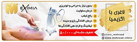 جدید ترین روش های لاغری موضعی لاغری موضعی,روش های لاغری موضعی,جدید ترین روش های لاغری موضعی