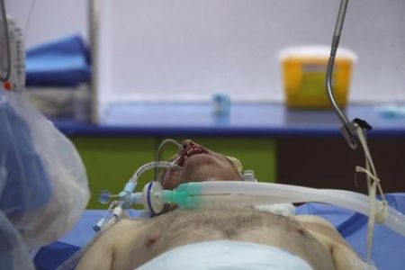 اخبار پزشکی ,خبرهای پزشکی ,آی سی یو اخبار پزشکی ,خبرهای پزشکی,آی سی یو
