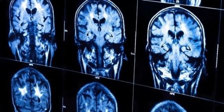 اخبار پزشکی ,خبرهای پزشکی ,دانشمندان ایرانی اخبار پزشکی ,خبرهای پزشکی,دانشمندان ایرانی