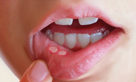 اخبار پزشکی ,خبرهای پزشکی , اخبار پزشکی ,خبرهای پزشکی,