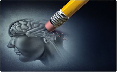 اخبار,اخبار پزشکی,پیشبینی و درمان آلزایمر با کمک هوش مصنوعی اخبار,اخبار پزشکی,پیشبینی و درمان آلزایمر با کمک هوش مصنوعی