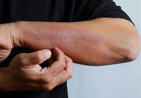 اخبار پزشکی ,خبرهای پزشکی ,کرونا اخبار پزشکی ,خبرهای پزشکی,کرونا