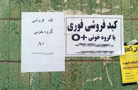 اخبار,اخبار اجتماعی,خرید و فروش اعضای بدن اخبار,اخبار اجتماعی,خرید و فروش اعضای بدن
