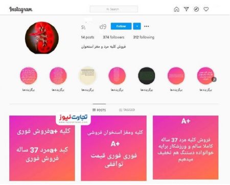 اخبار,اخبار اجتماعی,خرید و فروش اعضای بدن اخبار,اخبار اجتماعی,خرید و فروش اعضای بدن
