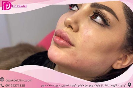 معرفی انواع ژل لب تزریق ژل لب,تزریق ژل چیست