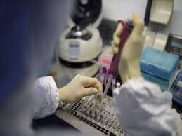 اخبار پزشکی ,خبرهای پزشکی , متخصص عفونی اخبار پزشکی ,خبرهای پزشکی, متخصص عفونی