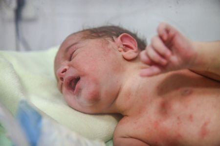 اخبار پزشکی ,خبرهای پزشکی ,متولد روز رُند اخبار پزشکی ,خبرهای پزشکی,متولد روز رُند