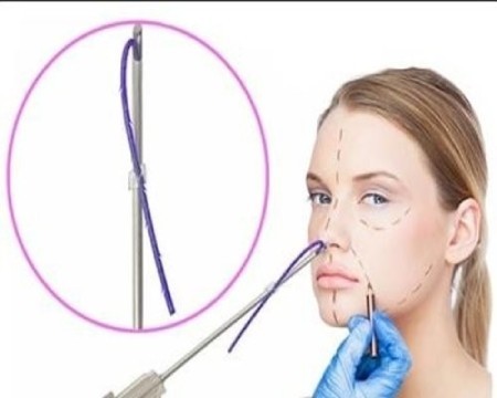 لیفت بینی دائمی لیفت بینی,لیفت بینی بدون جراحی,لیفت بینی با نخ