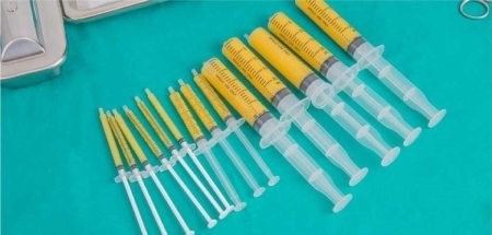 تزریق چربی تزریق چربی,تزریق چربی به صورت
