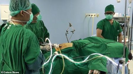 اخبارگوناگون,خبرهای گوناگون ,چاق ترین کودک دنیا اخبارگوناگون,خبرهای گوناگون ,چاق ترین کودک دنیا