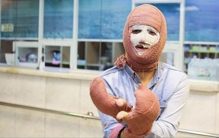 چهارشنبه سوری،اخبار پزشکی ،خبرهای پزشکی چهارشنبه سوری,اخبار پزشکی ,خبرهای پزشکی