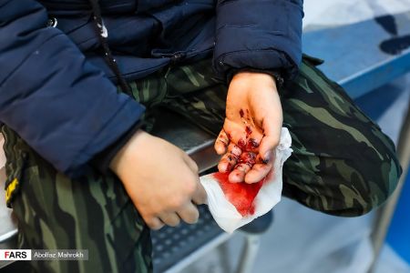 حوادث شب چهارشنبه سوری ،اخبارحوادث،خبرهای حوادث حوادث شب چهارشنبه سوری,اخبار حوادث,خبرهای حوادث