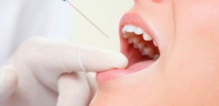 حکم وارد کردن وسائل دندانپزشکی در دهان در ماه رمضان