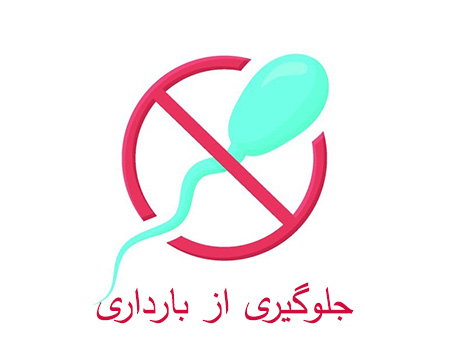 شرعی جلوگیری از بارداری, احکام شرعی جلوگیری از باردای, پرسش هایی برای جلوگیری از باردای