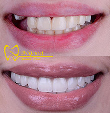 دندانپزشکی دندانپزشکی