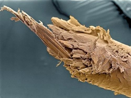 عکس میکروسکوپی از چشم,اعضای بدن زیر میکروسکوپ