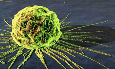 سرطان, سلولهای سرطانی, ویژگیهای سلولهای سرطانی