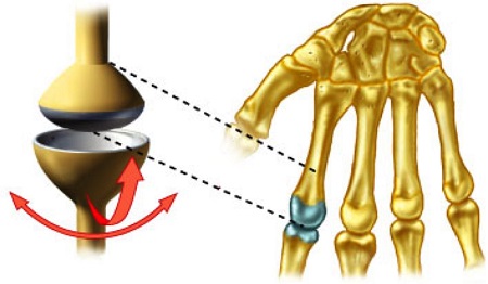 عکس مفاصل بدن,مفصل زانو,مفصل لقمه ای