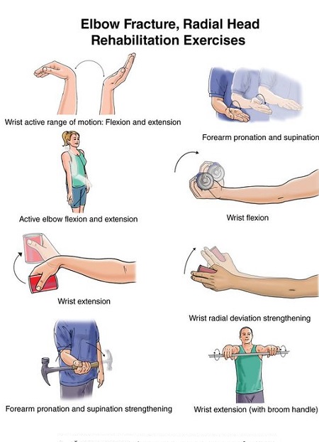 تمرینات فیزیوتراپی برای درمان شکستگی آرنج, حرکت کششی مچ دست, کشش مچ دست