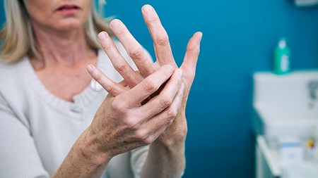 تمرینات ورزشی‌ برای درمان آرتروز دست , عارضه ی آرتروز دست , درمان آرتروز دست