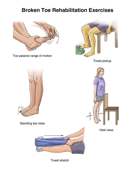 ورزش,ورزش برای شکستگی انگشتان پا,درمان شکستگی انگشتان پا