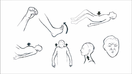 تن آرامی عضلانی آرامسازی پیشرونده عضلانی, ریلکسیشن جاکوبسون