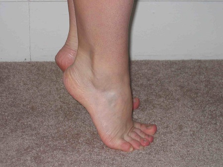 حرکات اصلاحی مچ پای پیچ خورده, اقدامات بعد از پیچ خوردگی مچ پا, ورزش مچ پای پیچ خورده