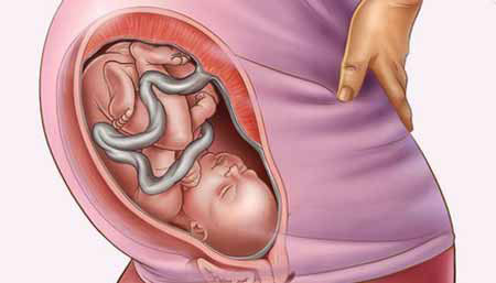 سرویکس چیست, طول سرویکس, اندازه طبیعی دهانه رحم در بارداری