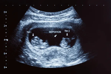 تغییرات بدن مادر در هفته هشتم