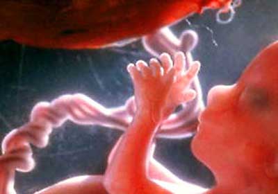دوران بارداری,مرگ جنین در بارداری,سقط جنین