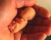 سقط جنین,پیامدهای سقط جنین