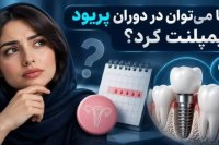 آیا میتوان در دوران پریود ایمپلنت کرد؟ (ایمپلنت در دوران قاعدگی) ایمپلنت در دوران قاعدگی