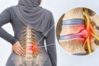 علت دیسک کمر در خانمهای تهرانی چیست؟ دیسک کمر